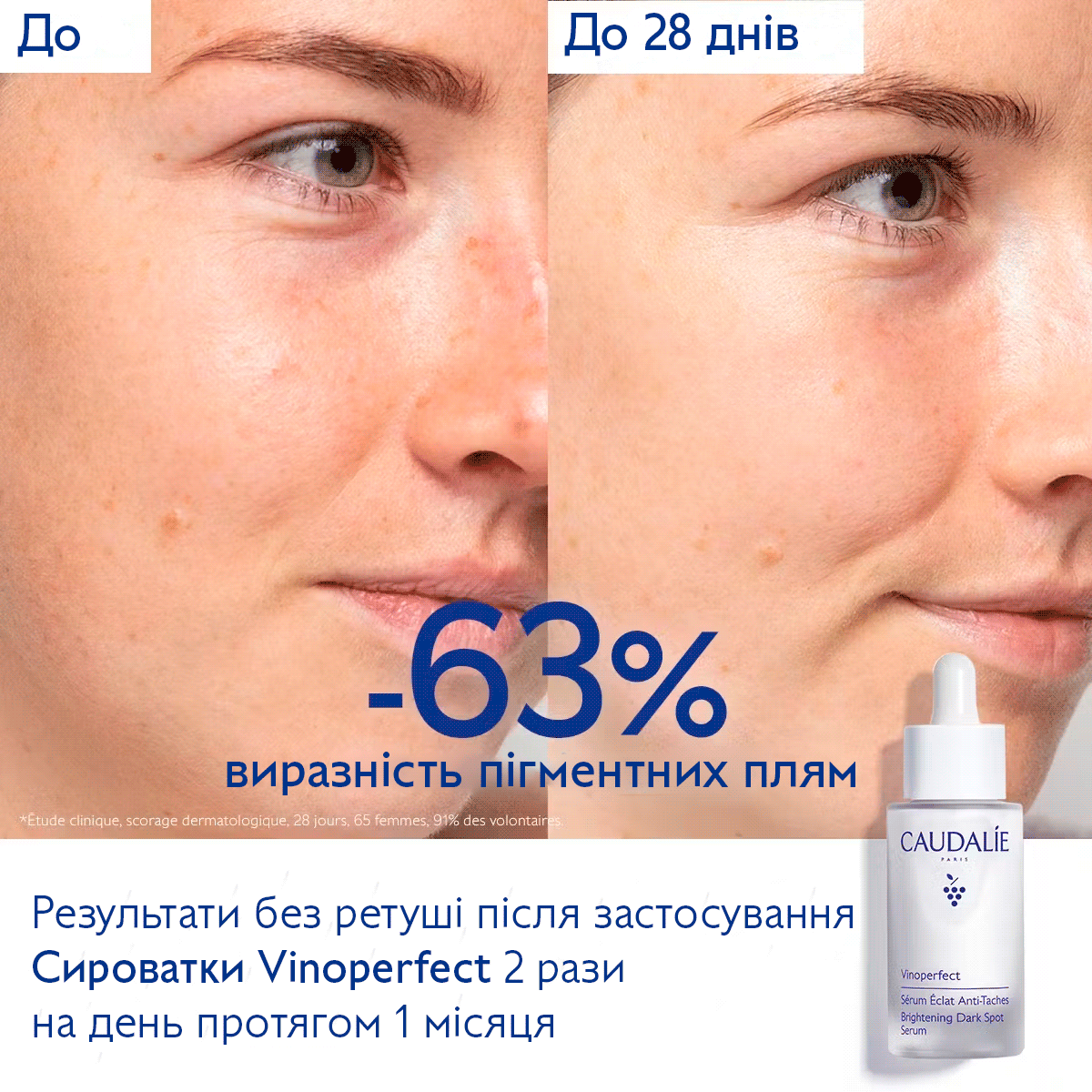 Vinoperfect Летний дуэт против пигментных пятен