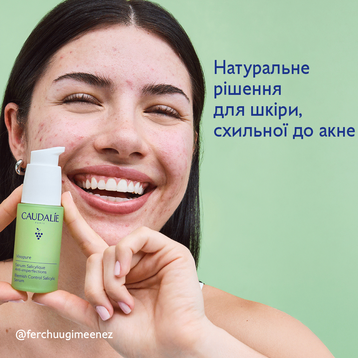 Vinopure Сироватка для проблемної шкіри із саліциловою кислотою
