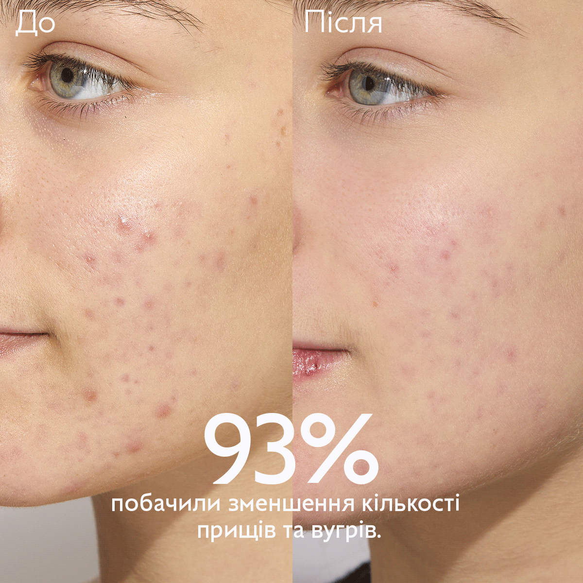 Vinopure Зволожуючий матуючий флюїд