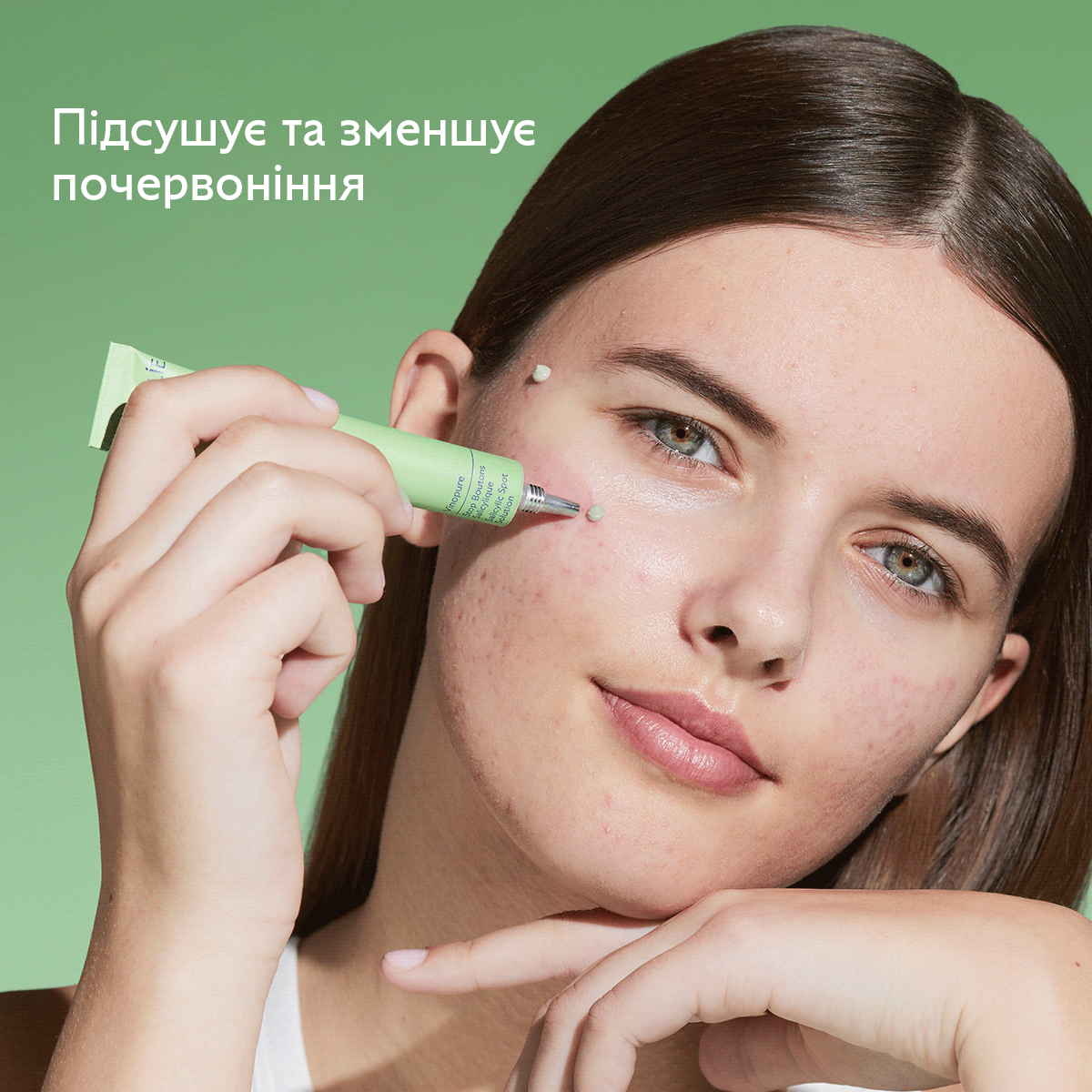 Vinopure SOS Точковий засіб проти недосконалостей із Саліциловою Кислотою
